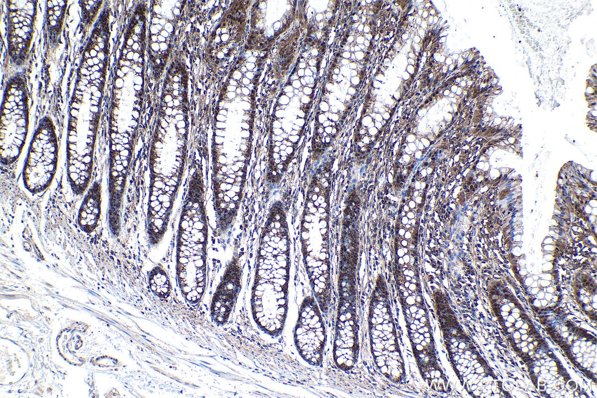 Immunohistochemical analysis of paraffin-embedded human colon tissue slide using KHC1172 (PSMA1 IHC Kit).