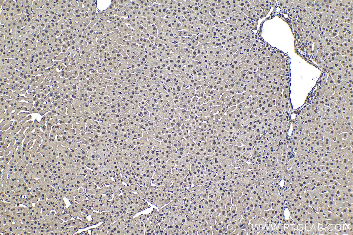 Immunohistochemical analysis of paraffin-embedded rat liver tissue slide using KHC1563 (PSMA3 IHC Kit).