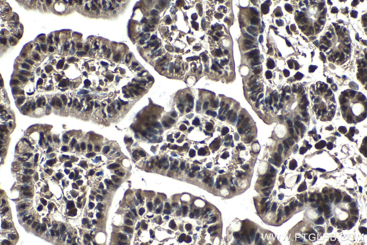 Immunohistochemical analysis of paraffin-embedded mouse small intestine tissue slide using KHC1563 (PSMA3 IHC Kit).