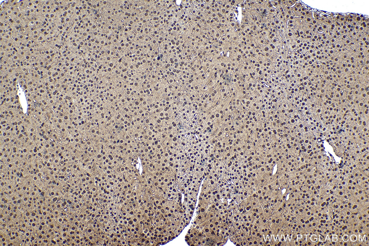 Immunohistochemical analysis of paraffin-embedded mouse liver tissue slide using KHC1563 (PSMA3 IHC Kit).