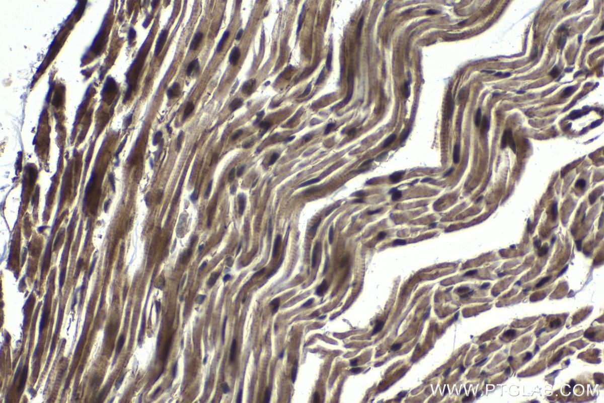 Immunohistochemical analysis of paraffin-embedded mouse heart tissue slide using KHC1563 (PSMA3 IHC Kit).