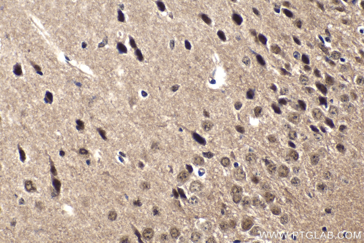 Immunohistochemical analysis of paraffin-embedded mouse brain tissue slide using KHC1571 (PSMA5 IHC Kit).
