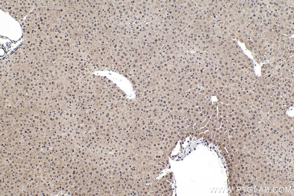 Immunohistochemical analysis of paraffin-embedded mouse liver tissue slide using KHC1571 (PSMA5 IHC Kit).