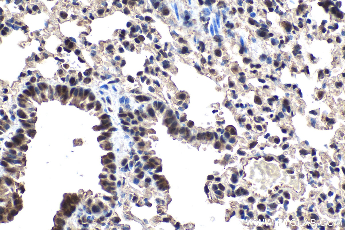 Immunohistochemical analysis of paraffin-embedded mouse lung tissue slide using KHC1571 (PSMA5 IHC Kit).