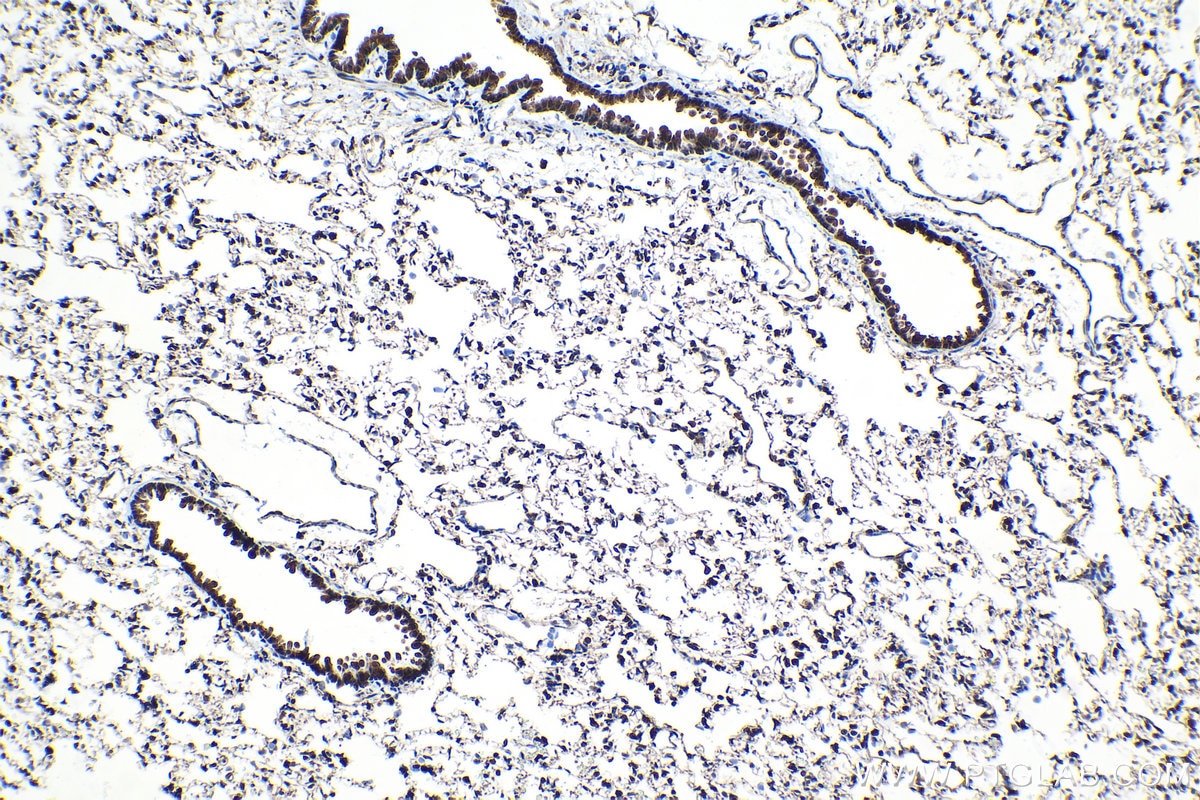 Immunohistochemical analysis of paraffin-embedded rat lung tissue slide using KHC1571 (PSMA5 IHC Kit).