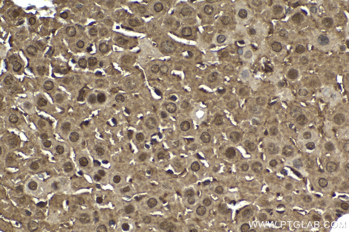 Immunohistochemical analysis of paraffin-embedded mouse liver tissue slide using KHC1638 (PSMA6 IHC Kit).