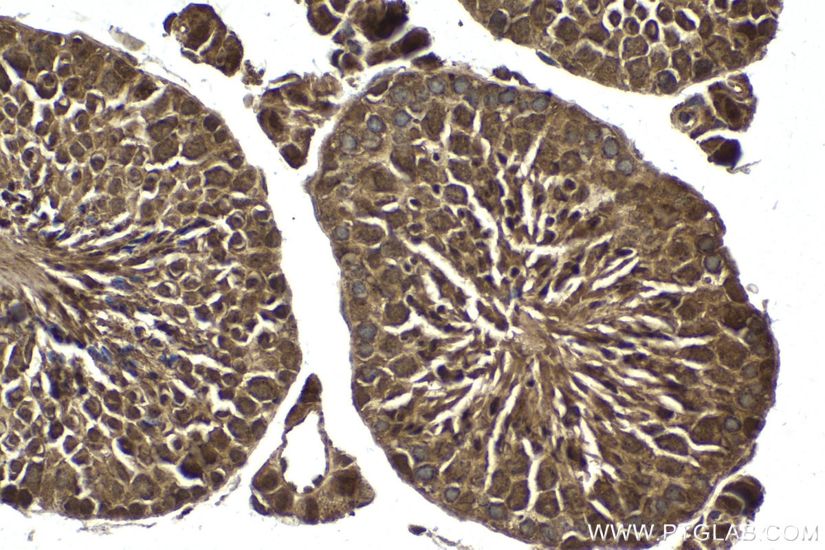 Immunohistochemical analysis of paraffin-embedded mouse testis tissue slide using KHC1638 (PSMA6 IHC Kit).