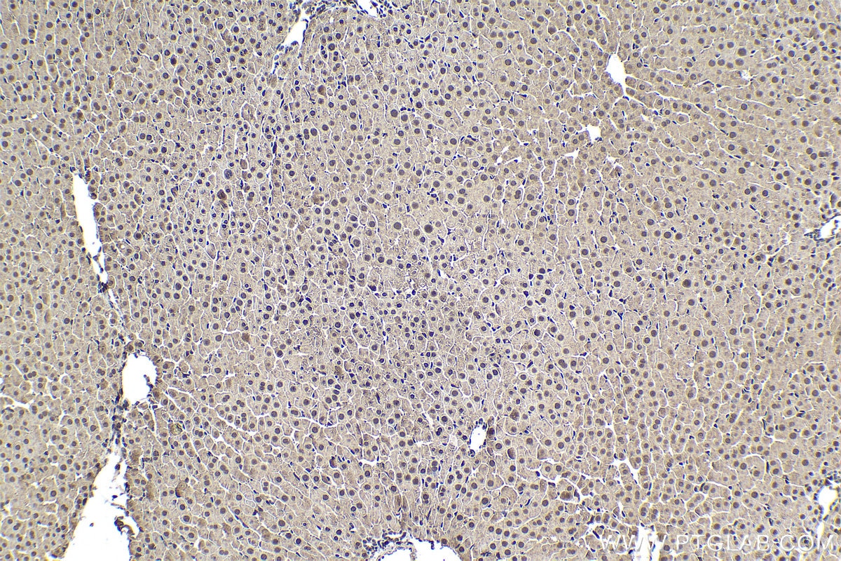 Immunohistochemical analysis of paraffin-embedded rat liver tissue slide using KHC1638 (PSMA6 IHC Kit).