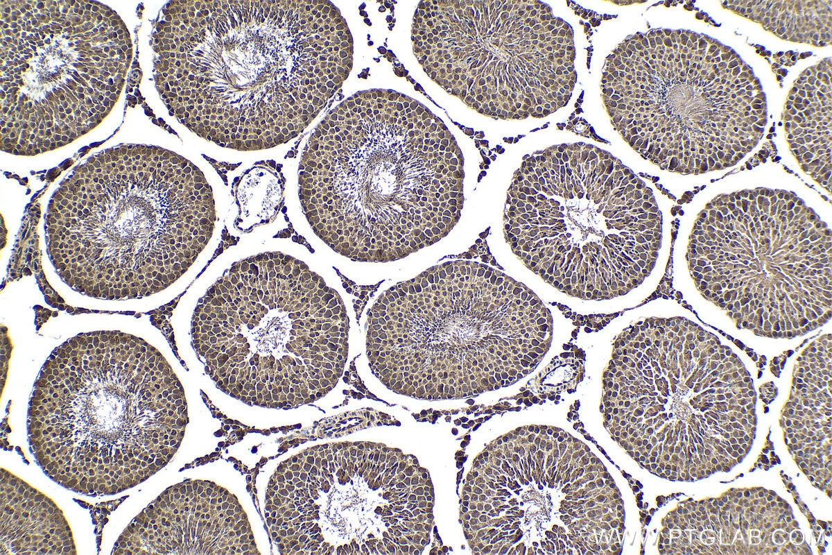 Immunohistochemical analysis of paraffin-embedded rat testis tissue slide using KHC1638 (PSMA6 IHC Kit).