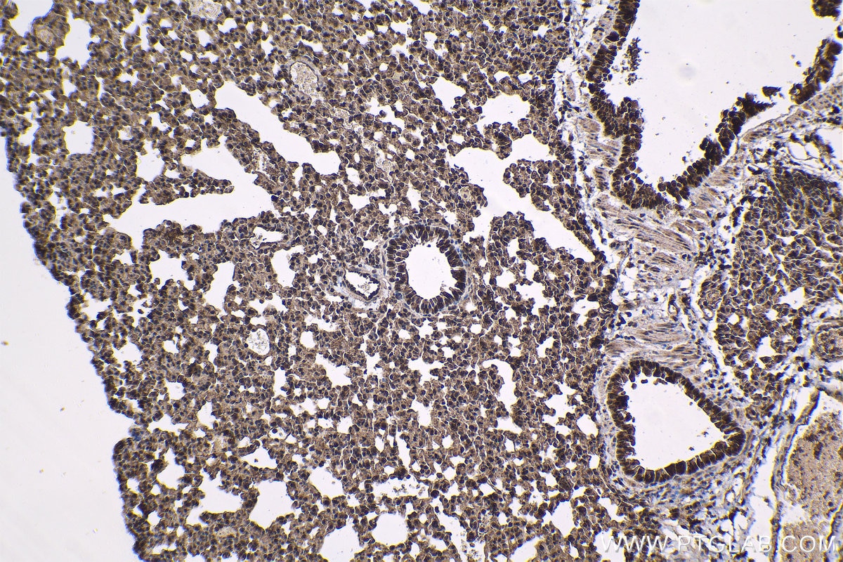 Immunohistochemical analysis of paraffin-embedded mouse lung tissue slide using KHC1429 (PSMA7 IHC Kit).