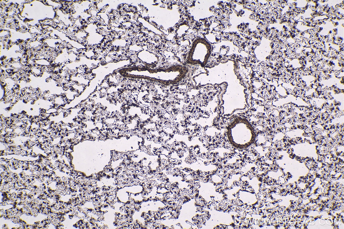 Immunohistochemical analysis of paraffin-embedded rat lung tissue slide using KHC1429 (PSMA7 IHC Kit).