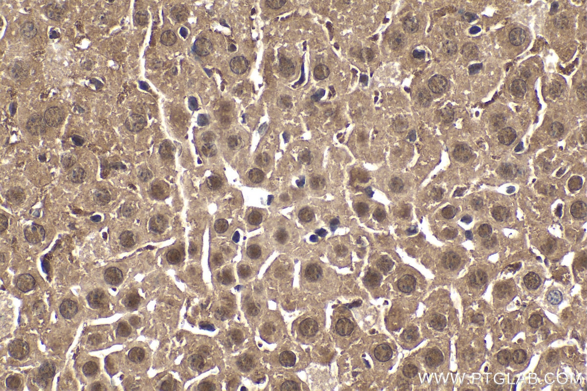 Immunohistochemical analysis of paraffin-embedded mouse liver tissue slide using KHC1550 (PSMB1 IHC Kit).