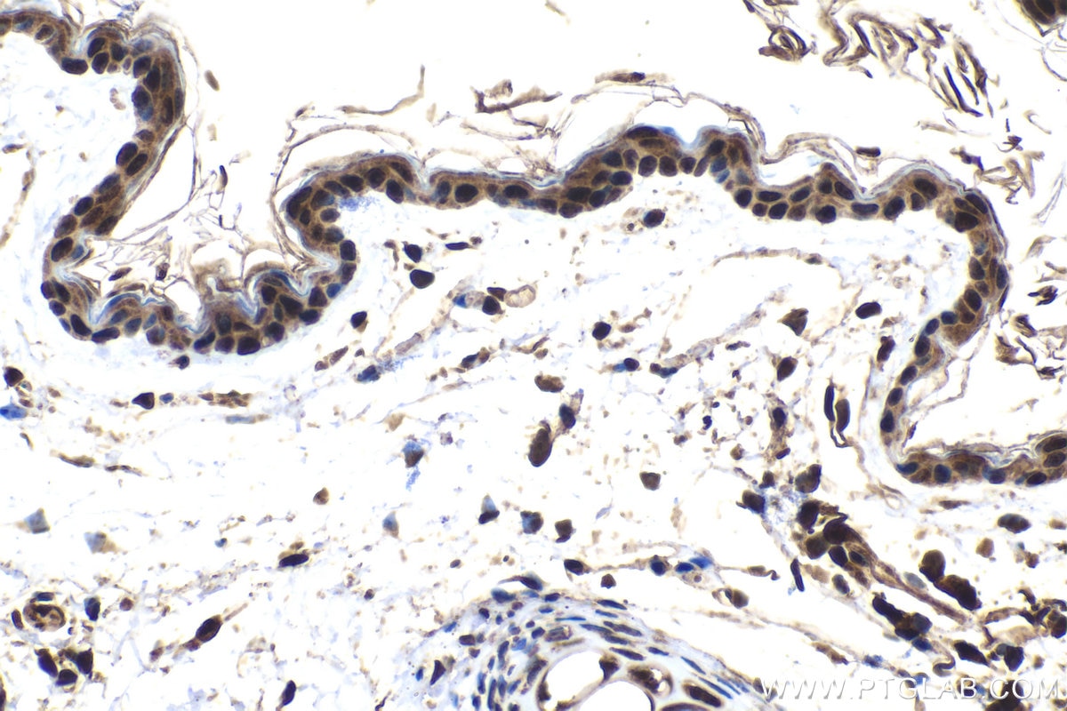 Immunohistochemical analysis of paraffin-embedded mouse skin tissue slide using KHC1550 (PSMB1 IHC Kit).