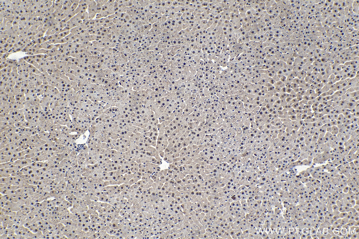 Immunohistochemical analysis of paraffin-embedded rat liver tissue slide using KHC1550 (PSMB1 IHC Kit).