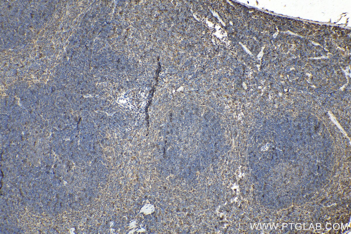 Immunohistochemical analysis of paraffin-embedded mouse spleen tissue slide using KHC1591 (PSMB10 IHC Kit).