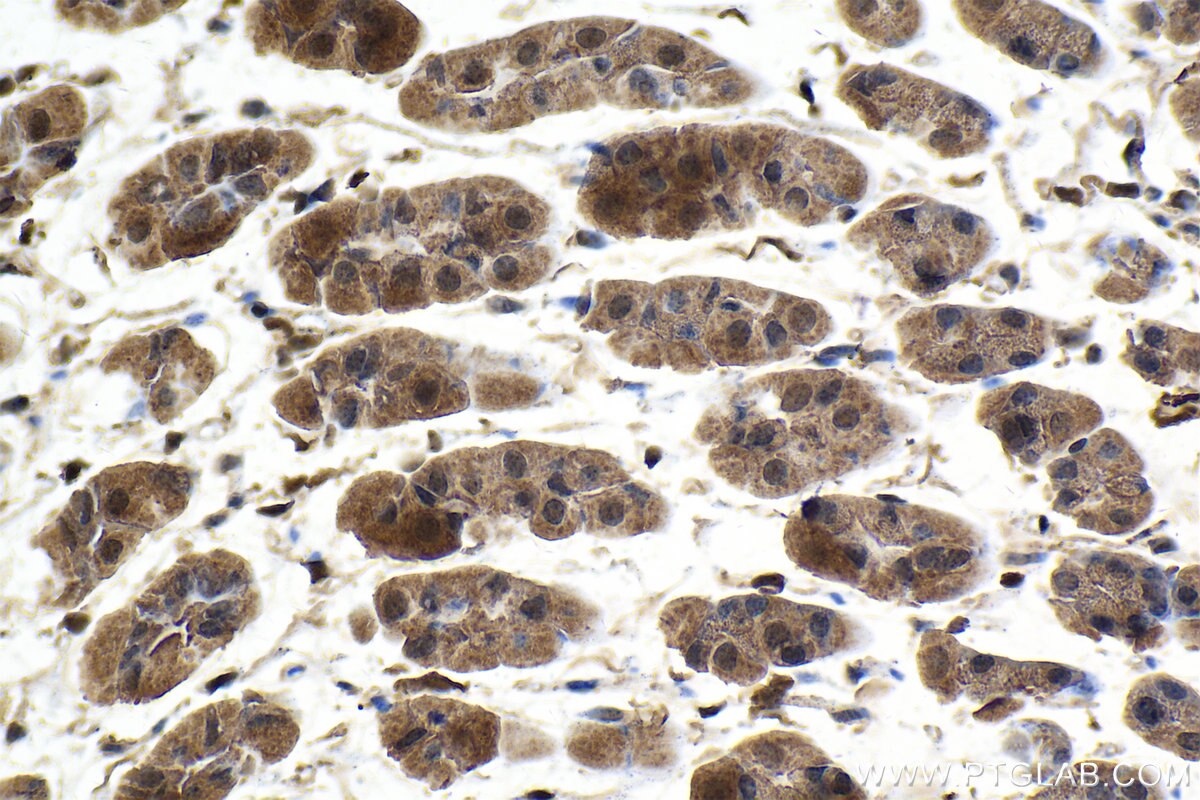 Immunohistochemical analysis of paraffin-embedded mouse stomach tissue slide using KHC1591 (PSMB10 IHC Kit).