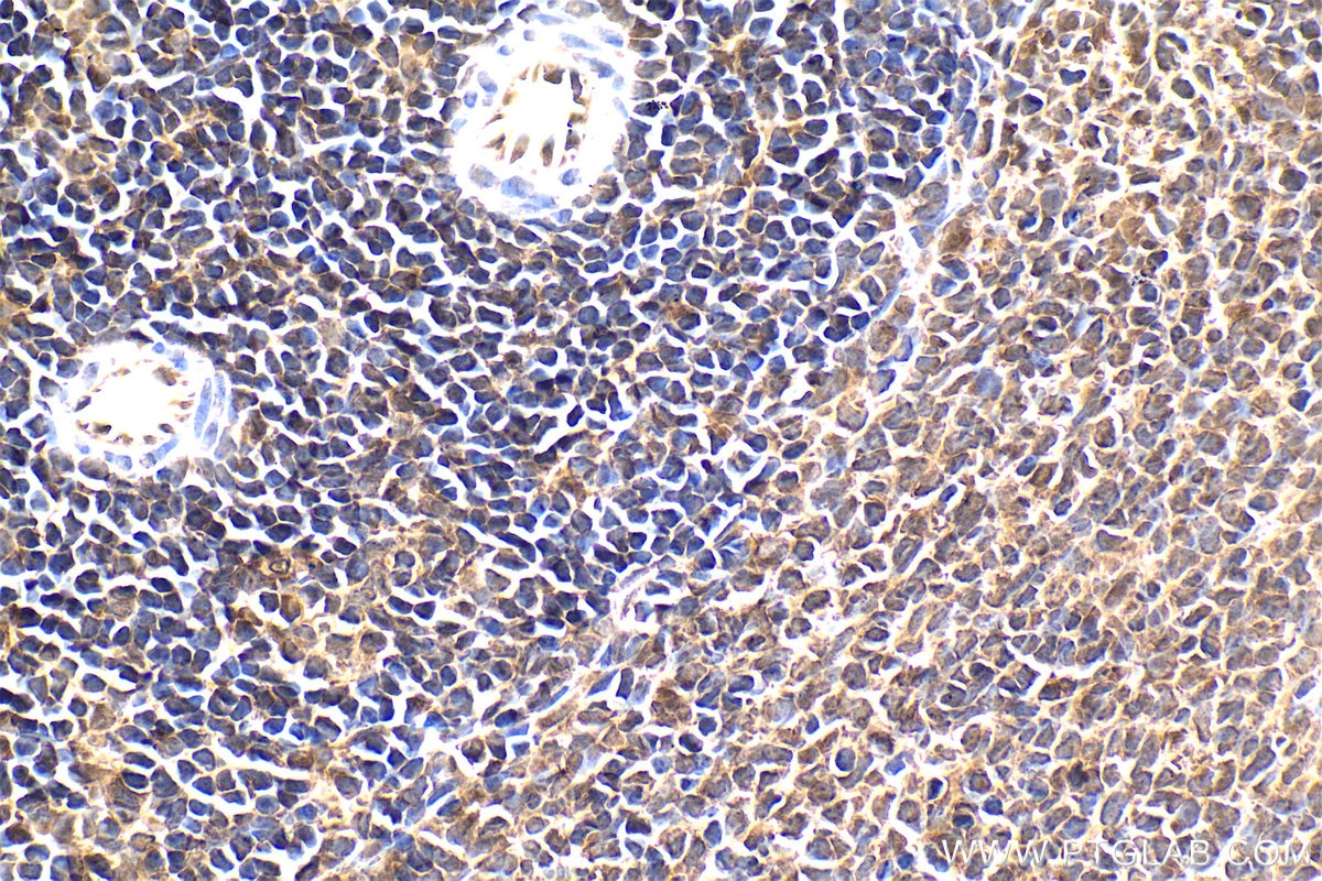 Immunohistochemical analysis of paraffin-embedded rat spleen tissue slide using KHC1591 (PSMB10 IHC Kit).