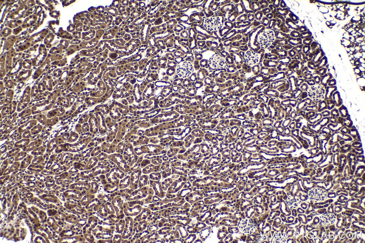 Immunohistochemical analysis of paraffin-embedded mouse kidney tissue slide using KHC1614 (PSMB3 IHC Kit).