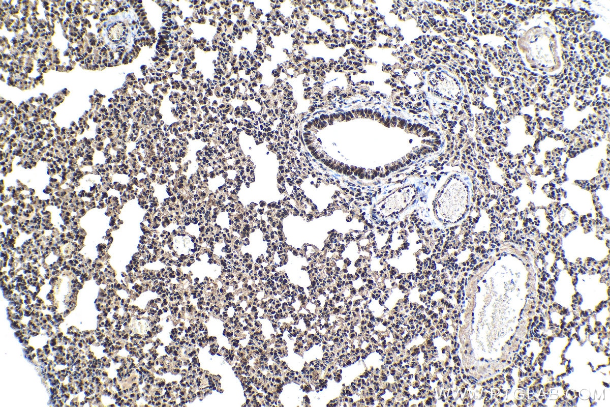 Immunohistochemical analysis of paraffin-embedded mouse lung tissue slide using KHC1572 (PSMB4 IHC Kit).