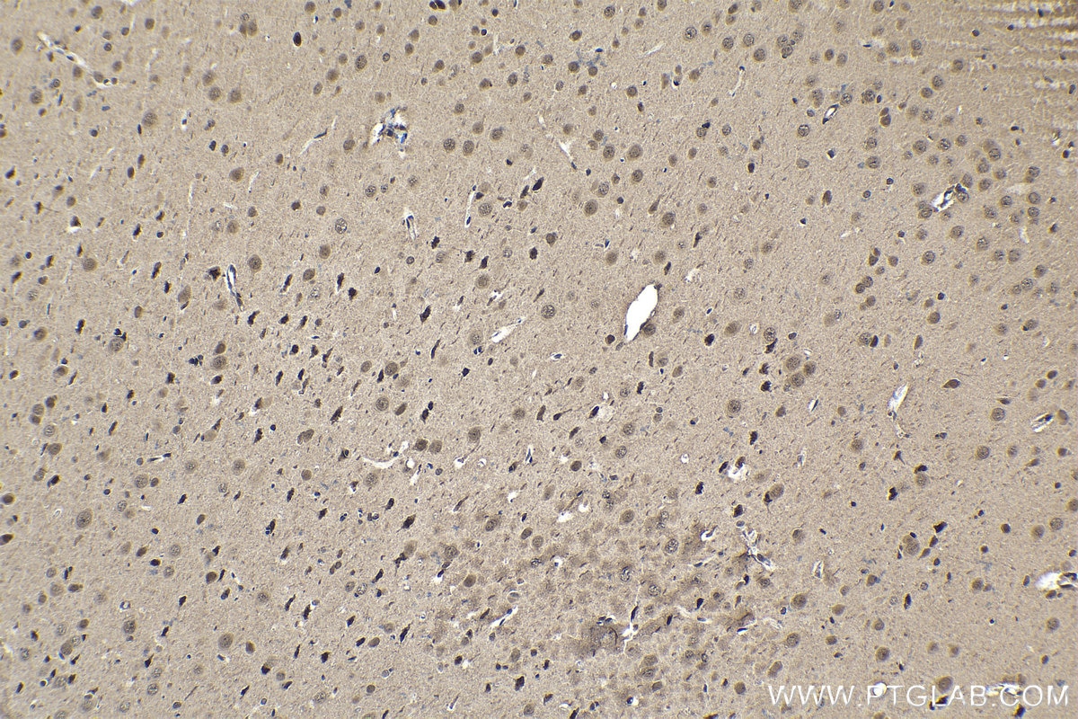 Immunohistochemical analysis of paraffin-embedded rat brain tissue slide using KHC1572 (PSMB4 IHC Kit).