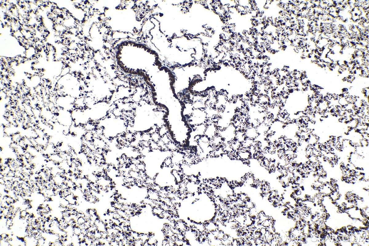 Immunohistochemical analysis of paraffin-embedded rat lung tissue slide using KHC1572 (PSMB4 IHC Kit).