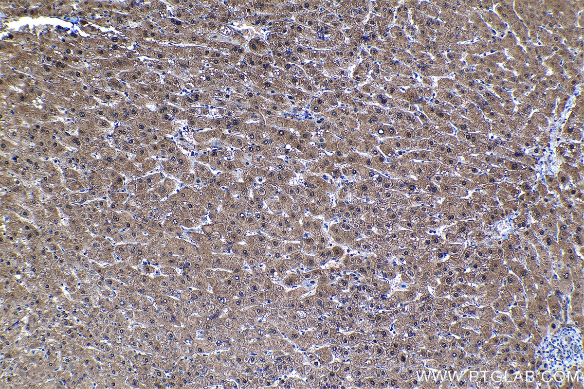 Immunohistochemical analysis of paraffin-embedded human liver tissue slide using KHC1308 (PSMB5 IHC Kit).