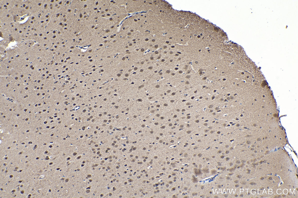 Immunohistochemical analysis of paraffin-embedded rat brain tissue slide using KHC1573 (PSMB6 IHC Kit).