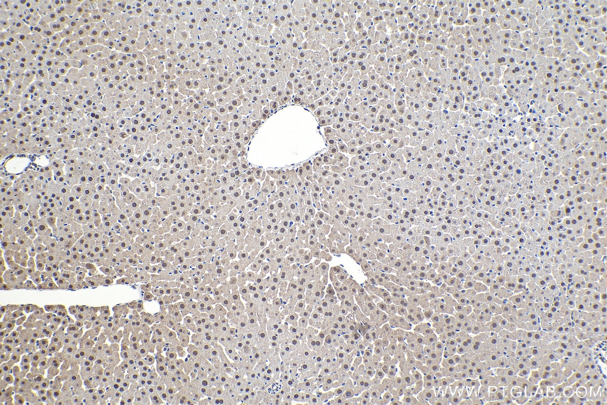 Immunohistochemical analysis of paraffin-embedded rat liver tissue slide using KHC1573 (PSMB6 IHC Kit).