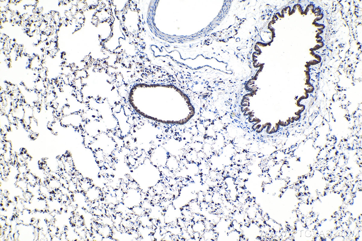 Immunohistochemical analysis of paraffin-embedded rat lung tissue slide using KHC1573 (PSMB6 IHC Kit).