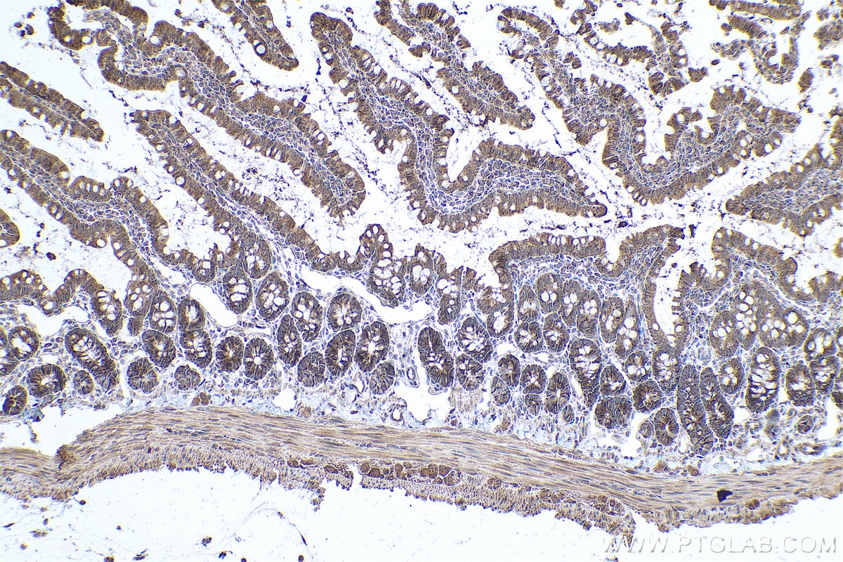 Immunohistochemical analysis of paraffin-embedded rat small intestine tissue slide using KHC0812 (PSMB7 IHC Kit).