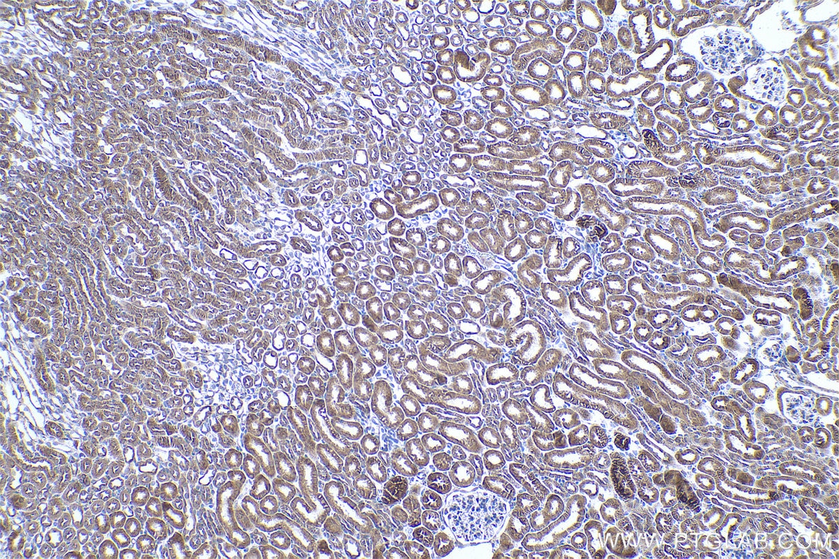 Immunohistochemical analysis of paraffin-embedded mouse kidney tissue slide using KHC0812 (PSMB7 IHC Kit).