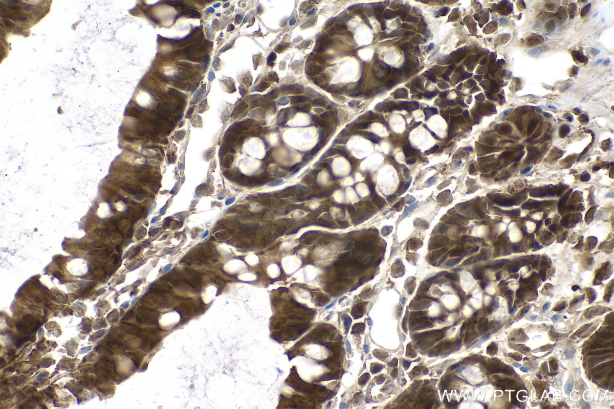 Immunohistochemical analysis of paraffin-embedded rat colon tissue slide using KHC0780 (PSMB8 IHC Kit).