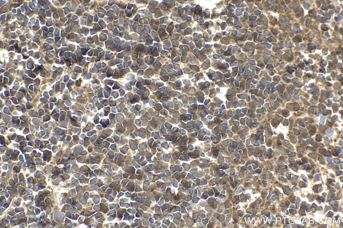 Immunohistochemical analysis of paraffin-embedded mouse spleen tissue slide using KHC1570 (PSMB9 IHC Kit).