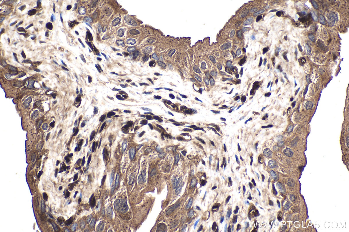 Immunohistochemical analysis of paraffin-embedded mouse bladder tissue slide using KHC1570 (PSMB9 IHC Kit).