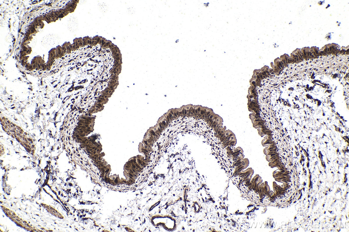 Immunohistochemical analysis of paraffin-embedded rat bladder tissue slide using KHC1570 (PSMB9 IHC Kit).