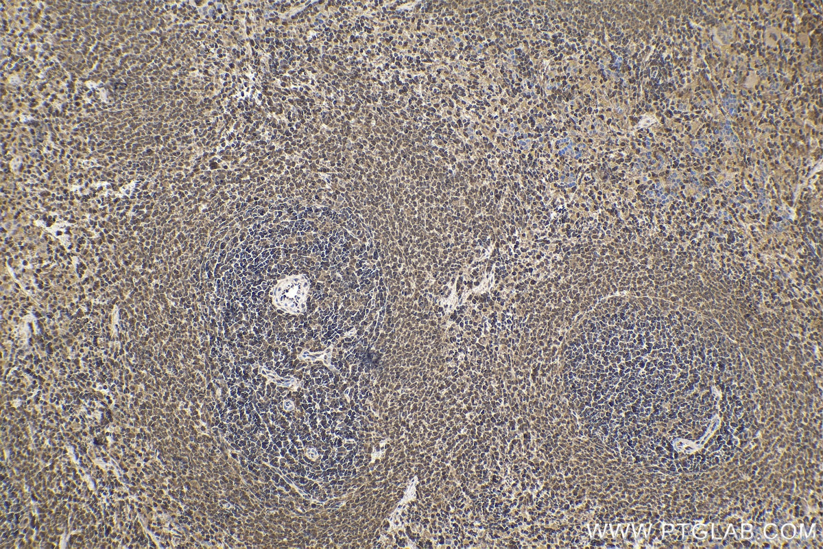 Immunohistochemical analysis of paraffin-embedded rat spleen tissue slide using KHC1570 (PSMB9 IHC Kit).