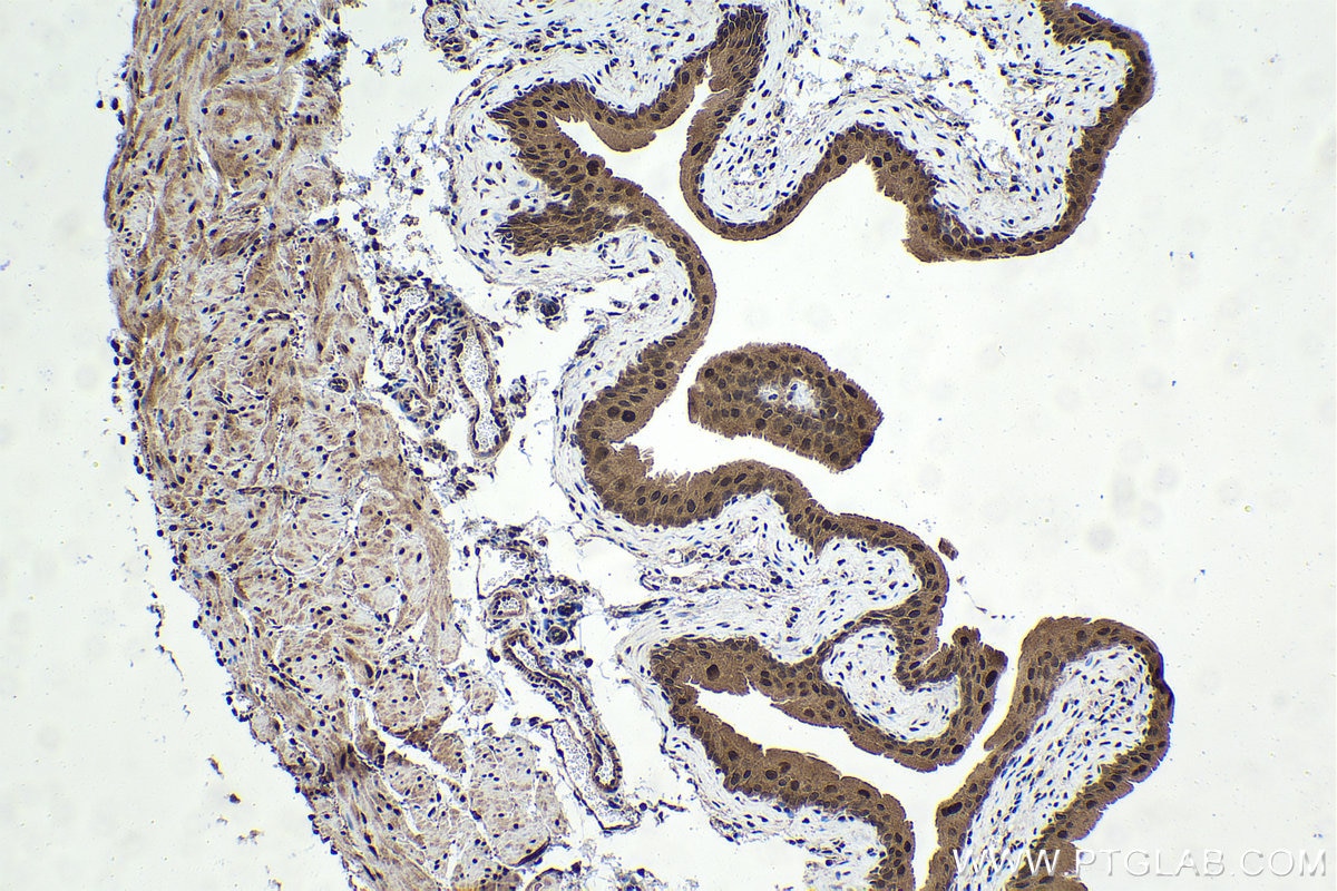 Immunohistochemical analysis of paraffin-embedded mouse bladder tissue slide using KHC1644 (PSMC1 IHC Kit).