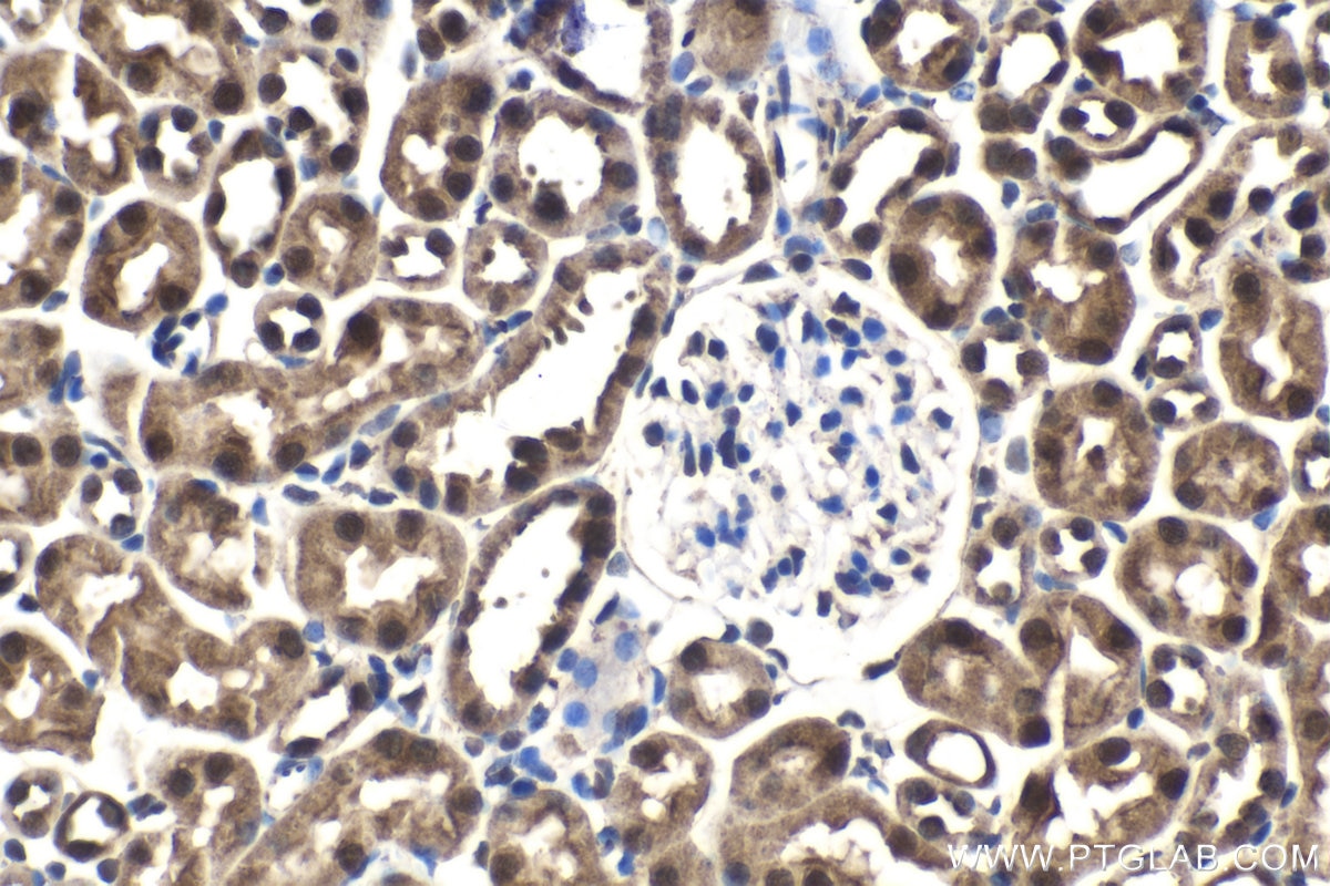 Immunohistochemical analysis of paraffin-embedded mouse kidney tissue slide using KHC1541 (PSMC3 IHC Kit).