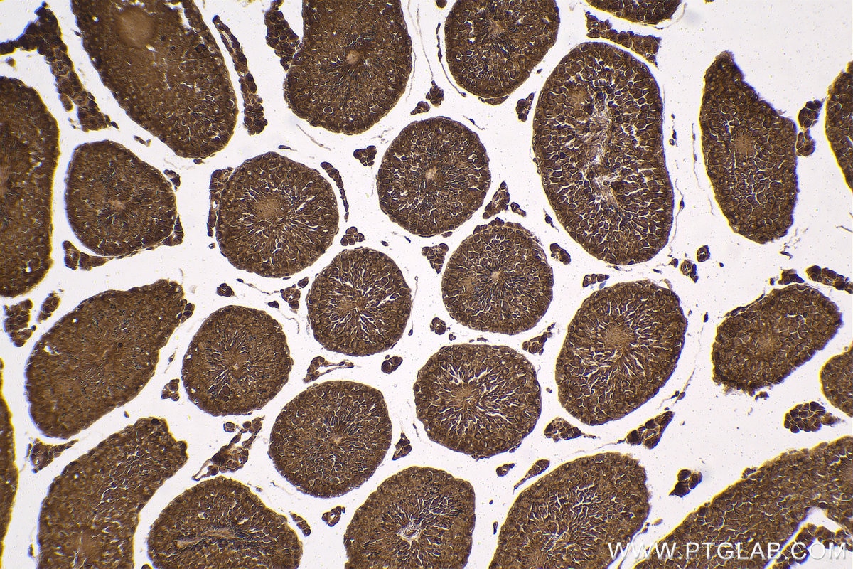 Immunohistochemical analysis of paraffin-embedded mouse testis tissue slide using KHC1598 (PSMC4 IHC Kit).