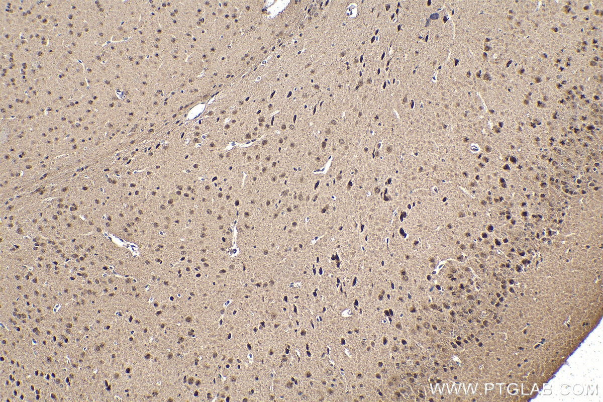 Immunohistochemical analysis of paraffin-embedded mouse brain tissue slide using KHC1646 (PSMC6 IHC Kit).