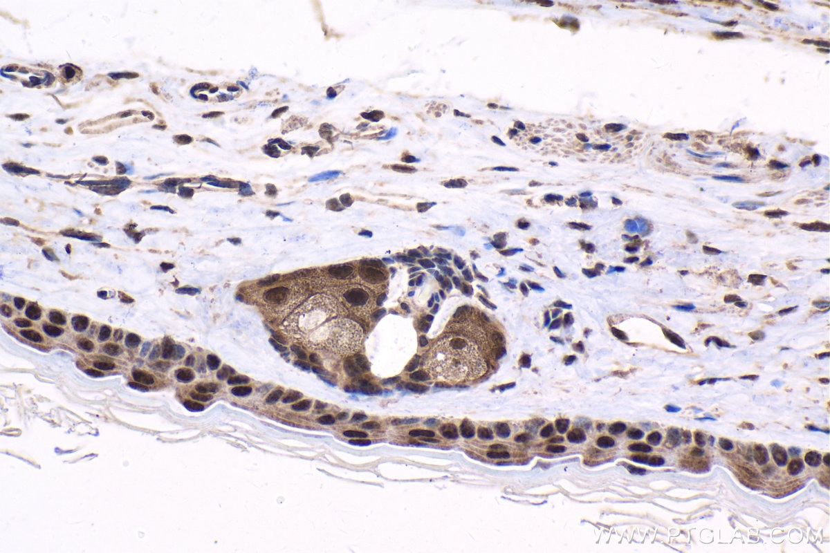 Immunohistochemical analysis of paraffin-embedded mouse skin tissue slide using KHC1646 (PSMC6 IHC Kit).