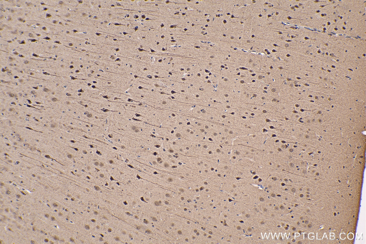 Immunohistochemical analysis of paraffin-embedded rat brain tissue slide using KHC1646 (PSMC6 IHC Kit).