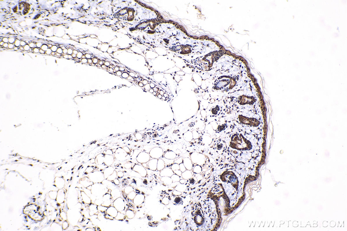 Immunohistochemical analysis of paraffin-embedded rat skin tissue slide using KHC1646 (PSMC6 IHC Kit).