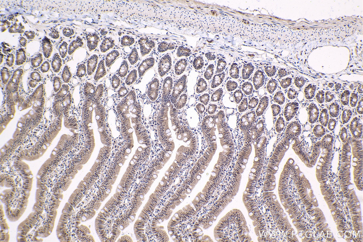 Immunohistochemical analysis of paraffin-embedded rat small intestine tissue slide using KHC1646 (PSMC6 IHC Kit).