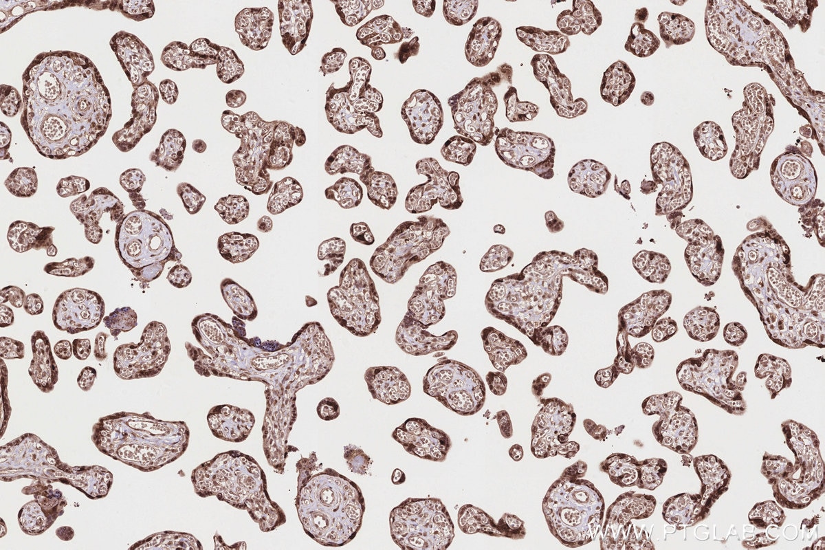 Immunohistochemical analysis of paraffin-embedded human placenta tissue slide using KHC2839 (PSMD1 IHC Kit).