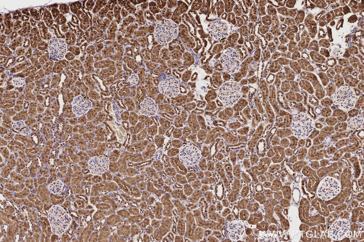 Immunohistochemical analysis of paraffin-embedded rat kidney tissue slide using KHC2839 (PSMD1 IHC Kit).