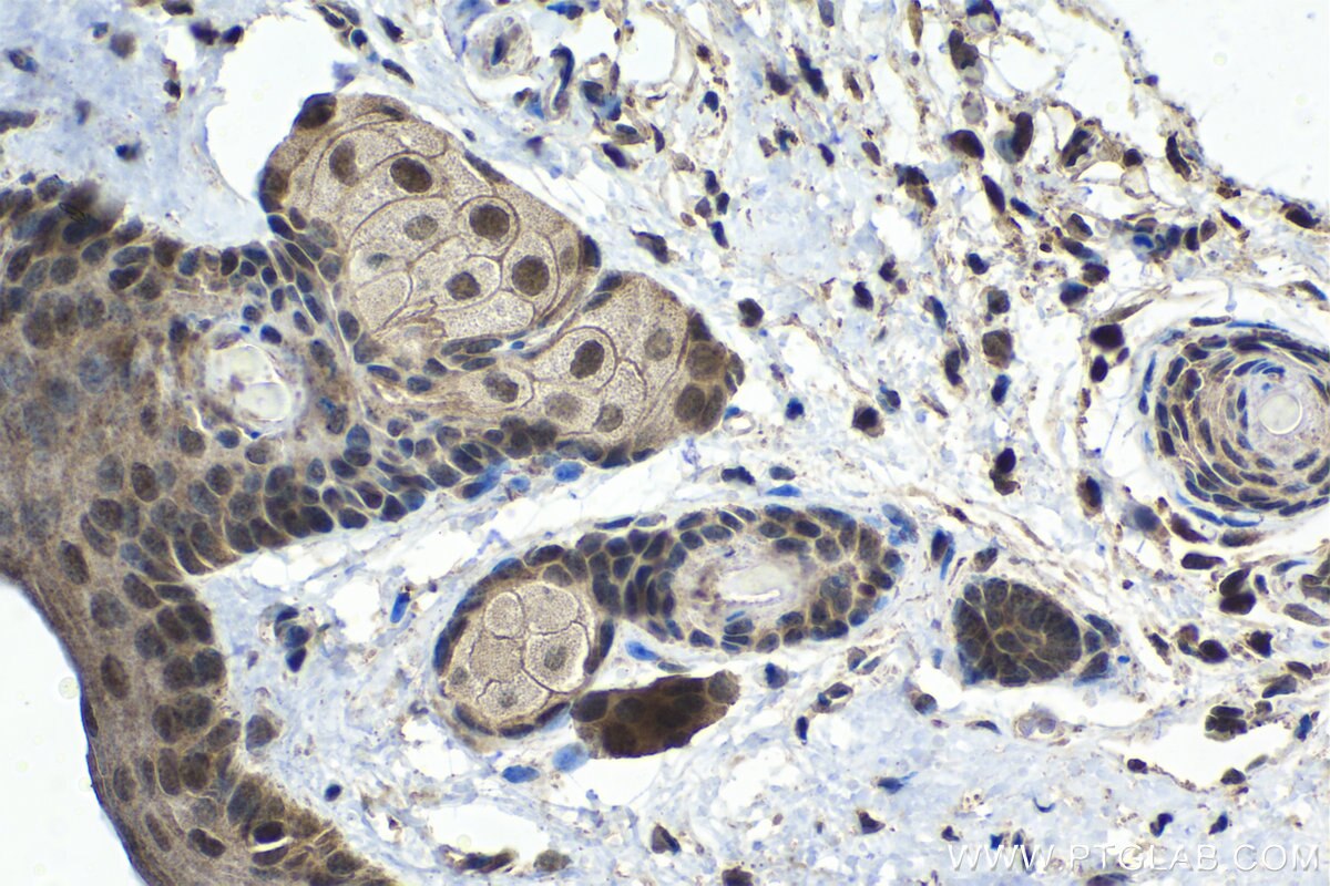 Immunohistochemical analysis of paraffin-embedded mouse skin tissue slide using KHC1477 (PSMD10 IHC Kit).