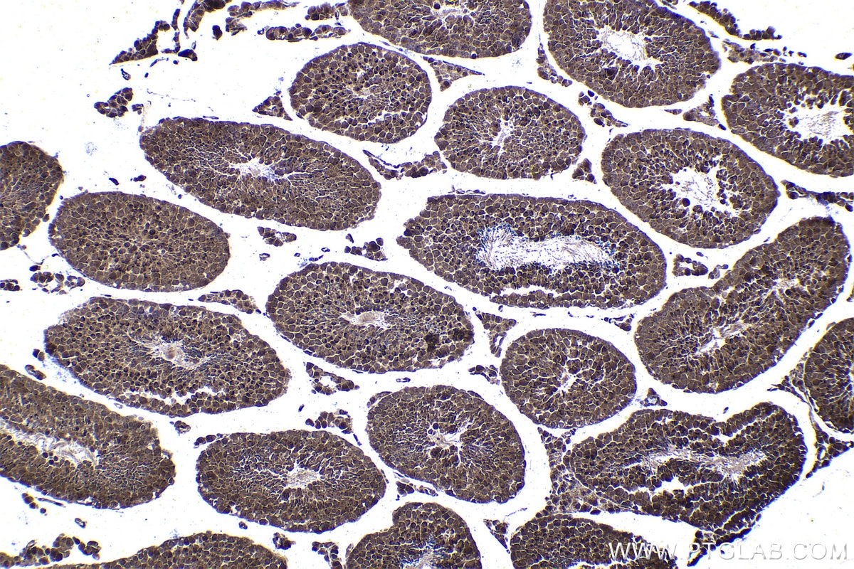 Immunohistochemical analysis of paraffin-embedded mouse testis tissue slide using KHC1419 (PSMD11 IHC Kit).