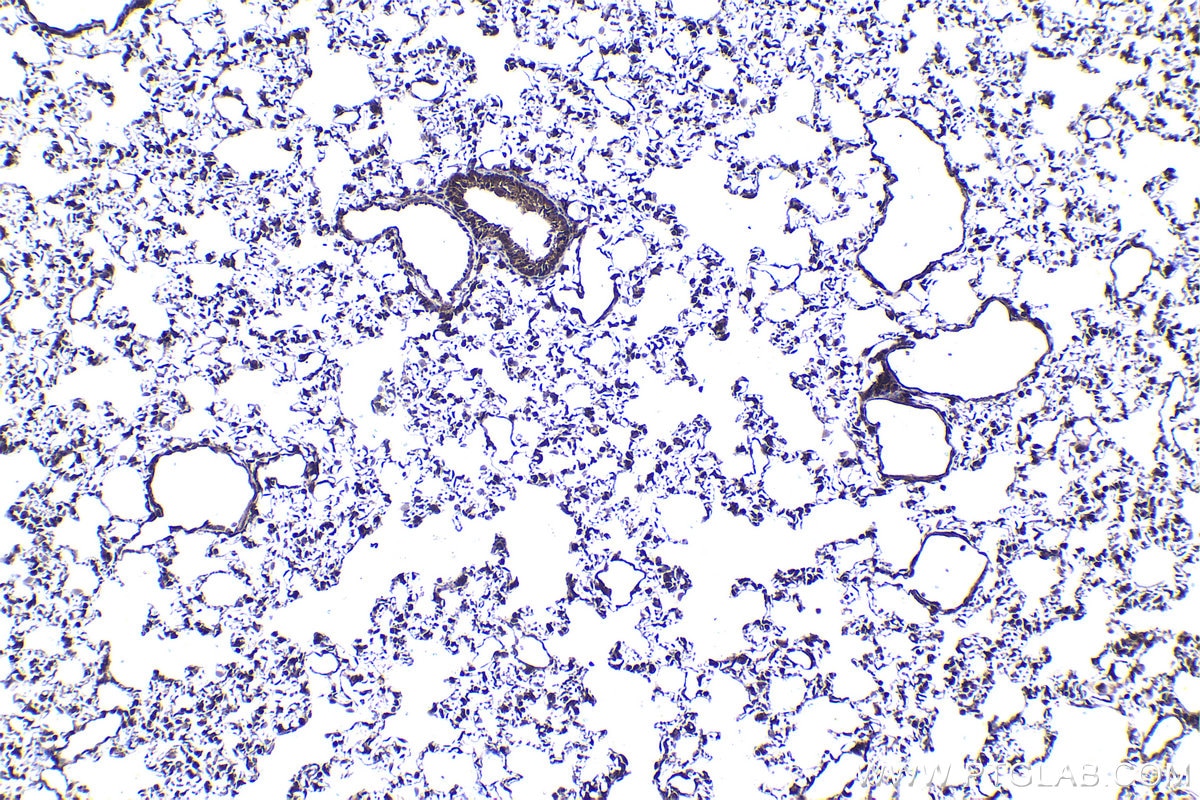 Immunohistochemical analysis of paraffin-embedded rat lung tissue slide using KHC1419 (PSMD11 IHC Kit).