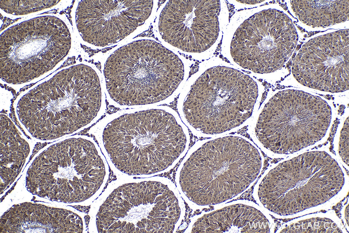 Immunohistochemical analysis of paraffin-embedded rat testis tissue slide using KHC1419 (PSMD11 IHC Kit).